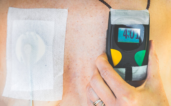 hand holter ecg device patch