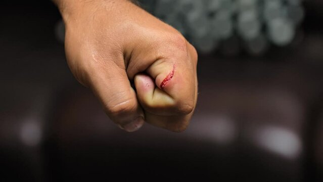 Deep scratches, cut on a man hand skin. Fresh wound, abrasions. Injured hand with blood. Close up