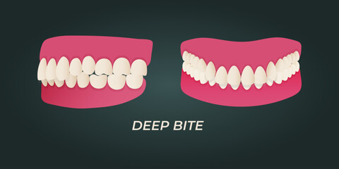 Medical dental diagram illustration. Orthodontist human tooth anatomy. Vector infographics with teeth diagrams.