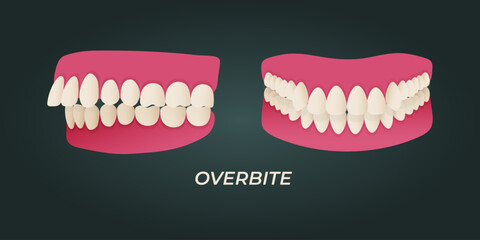 Medical dental diagram illustration. Orthodontist human tooth anatomy. Vector infographics with teeth diagrams.