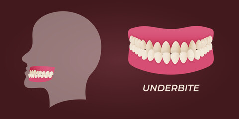 Medical dental diagram illustration. Orthodontist human tooth anatomy. Vector infographics with teeth diagrams.