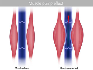 Skeletal Muscle pump effect. Illustration of muscle pump effect on venous return and muscle blood. Calf contracted and relaxed Muscles