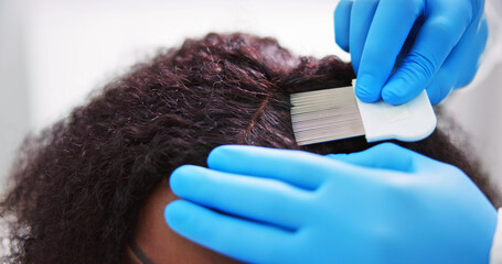 Scalp Treatment From Psoriasis And Dandruff