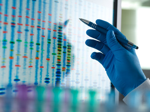 Scientist analysing a DNA profile after testing in the lab.