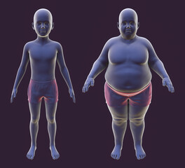 Fototapeta na wymiar Obese boy before and after gaining weight, 3D illustration. Concept of obesity