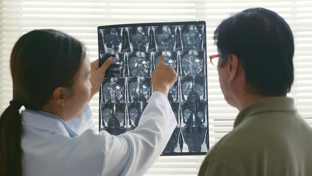 Young Asian woman doctor showing lung x-ray test results and describe to a senior patient in hospital. For cancer awareness month