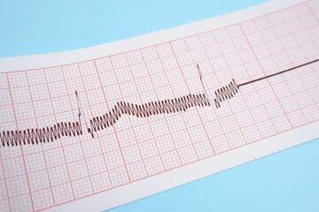 Minimal medical blue background
with ECG electrocardiography in paper form. Taking care of the health of the heart. Medical research. Heart Day.Close-up.