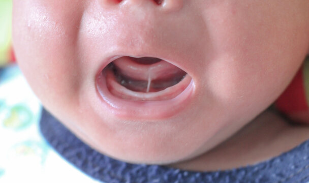 Baby Tongue Images – Browse 49,051 Stock Photos, Vectors, and Video | Adobe  Stock