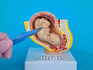Gynecologist doctor holds scalpel and abortion anatomy of fetus of child