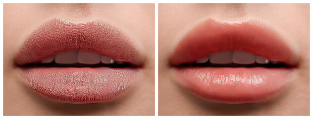 Collage with photos of woman before and after applying cosmetic balm on lips, closeup - obrazy, fototapety, plakaty