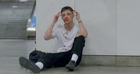 Inspired guy sings a song on the floor in the underpass. He moves his hands to the beat. bloodied...