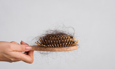 Woman hand holding a comb with hair loss on white background. Health care and medical, Hair loss...