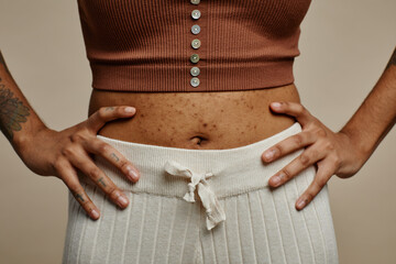 Close up of woman belly with real skin texture and acne scars