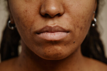 Macro shot of ethnic young woman with real skin texture and nude lips