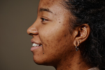 Close up smiling black woman with acne scars on face real skin texture