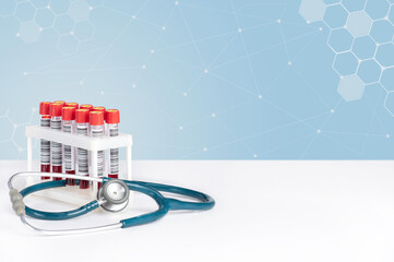 Blood samples in vacuum tubes and a stethoscope. Medical background