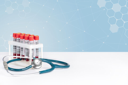 Blood samples in vacuum tubes and a stethoscope. Medical background