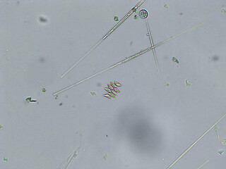 Diatoms, algae under microscopic view, phytoplankton, fossils, silica, golden yellow algae