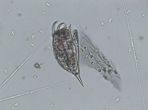 Freshwater aquatic zooplankton and algae under microscope view