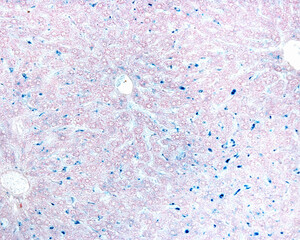 Liver. Kupffer cells labelled with Trypan blue