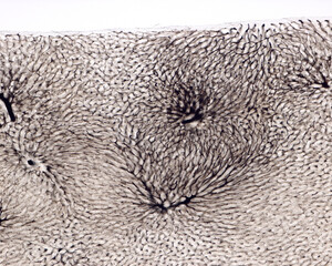 Liver. Blood vessels labelled with Indian ink