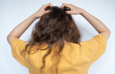 Fototapeta premium Rear view of young woman while scratching her scalp caused of itchy scalp.