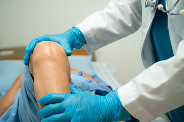 Asian senior or elderly old lady woman patient show her scars surgical total knee joint replacement...