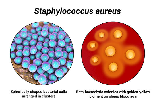 Bacteria Staphylococcus aureus, 3D illustration