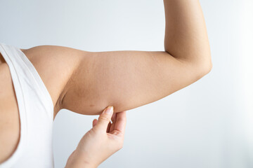 Cropped shot of a young woman with excess fat on her upper arm with marks for liposuction or...