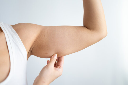Cropped shot of a young woman with excess fat on her upper arm with marks for liposuction or plastic surgery isolated on a gray background. The loose and saggy muscles. Overweight