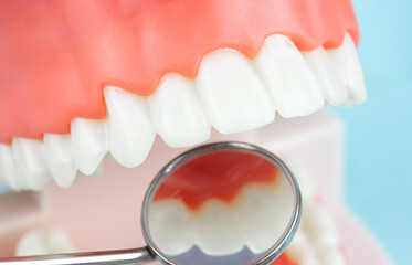 Fototapeta na wymiar Dentistry conceptual photo. Close-up individual tooth tray Orthodontic dental theme. Regular checkups are essential to oral health. Orthodontic tools, brace, bracket system, tooth,