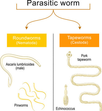 worm infection. Helminthiasis. Common types of parasitic worms or helminths