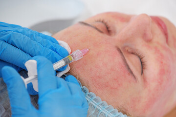 cosmetologist makes a mesotherapy or plasmolifting procedure for the patient. Biorevitalization is...