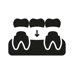 Dental Bridge Silhouette Icon. Tooth Regeneration. Porcelain Denture Glyph Pictogram. Partial Teeth Implant Restoration. Dental Treatment Solid Sign. Dentistry Symbol. Isolated Vector Illustration