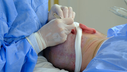 Fototapeta premium doctor operating on injured man. doctor treating injured man