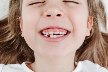 Happy smiling child portrait. Dental care, oral health. Close-up of teeth. Little todler attractive...