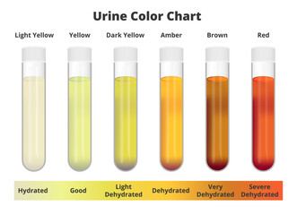 Urine color chart. Vector test tubes with different colors of urine or pee depicting hydrated and dehydrated samples. Light and dark yellow, amber, brown, and red urine. Medical test analysis. - obrazy, fototapety, plakaty
