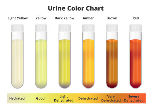 Concentrated Urine Color