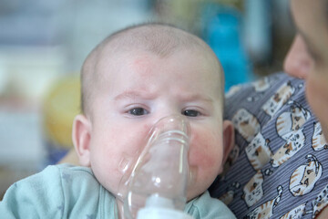 A sick child breathes with a nebulizer mask with a steam inhaler due to a respiratory disease. A...