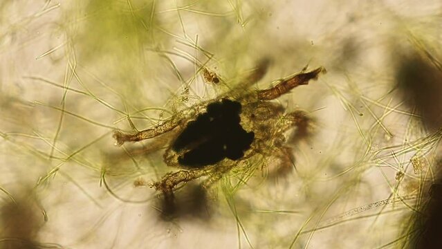 marine halacarid mite (Arthropoda of Order Prostigmata Family Halacaridae) from a reef aquarium under the microscope - light microscope x200 magnification