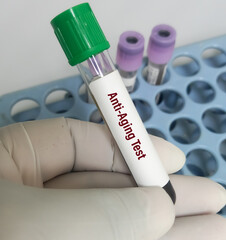 Blood sample for anti-aging test, anti-aging blood tests to pinpoint markers of aging.