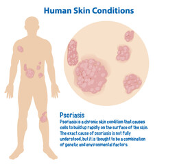 Obraz premium Human skin conditions infographic with explanation
