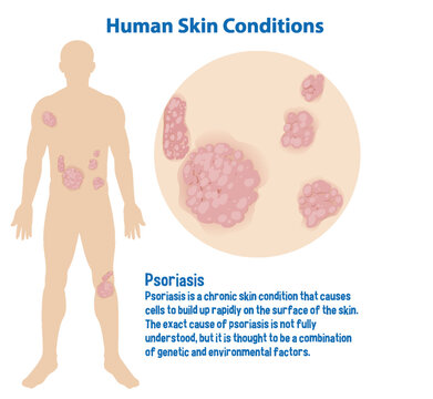 Human skin conditions infographic with explanation