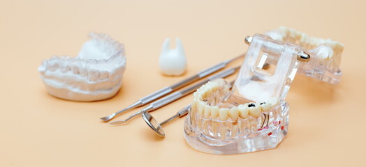 Fototapeta na wymiar Orthodontic dental theme on yellow background.Transparent invisible dental aligners or braces aplicable for an orthodontic dental treatment