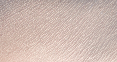 The skin is dry and wrinkled, senior person.