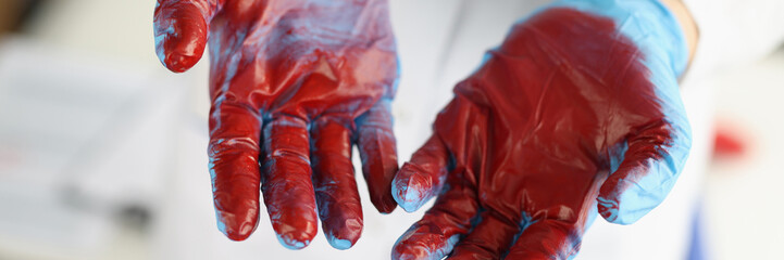 Surgeon in blue gloves with blood closeup
