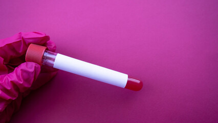 The doctor holds a test tube of blood for the virus. Sample blank white label for text in the...