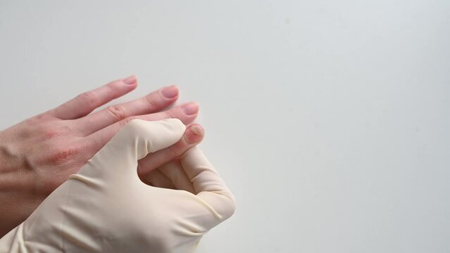 The doctor examines the affected nails - onycholysis close-up. Separation of the nail plate from the nail bed after manicure. Healthy lifestyle concept, podology