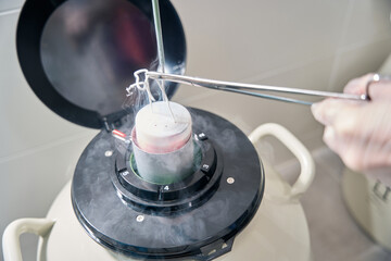 Specialist from cryostorage puts biomaterial into tank with liquid nitrogen