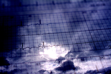 Electrocardiogram tracing that ends in clouds. Passage to heaven or the afterlife.